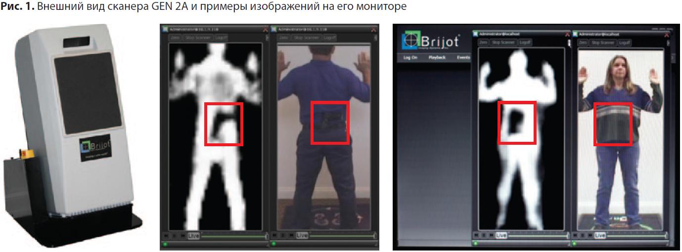 Черное изображение со сканера